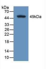 Calumenin Antibody in Western Blot (WB)