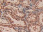 Caspase 3 Antibody in Immunohistochemistry (Paraffin) (IHC (P))