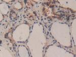 Caspase 3 Antibody in Immunohistochemistry (Paraffin) (IHC (P))