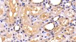 Caspase 8 Antibody in Immunohistochemistry (Paraffin) (IHC (P))