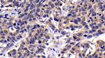 Caspase 8 Antibody in Immunohistochemistry (Paraffin) (IHC (P))