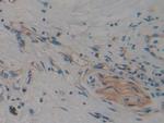 CARD9 Antibody in Immunohistochemistry (Paraffin) (IHC (P))