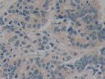 CARD9 Antibody in Immunohistochemistry (Paraffin) (IHC (P))