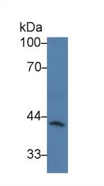 CARD9 Antibody in Western Blot (WB)