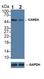 CARD9 Antibody in Western Blot (WB)