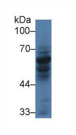 CARD9 Antibody in Western Blot (WB)