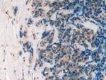 Cathepsin L Antibody in Immunohistochemistry (Paraffin) (IHC (P))