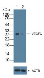 CENPH Antibody in Western Blot (WB)