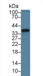 CENPH Antibody in Western Blot (WB)