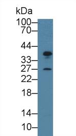 CENPH Antibody in Western Blot (WB)