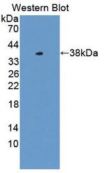 CENPH Antibody in Western Blot (WB)