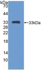 CENPH Antibody in Western Blot (WB)