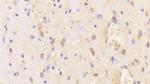 CHN2 Antibody in Immunohistochemistry (Paraffin) (IHC (P))