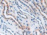 B7-H3 Antibody in Immunohistochemistry (Paraffin) (IHC (P))