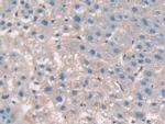 B7-H3 Antibody in Immunohistochemistry (Paraffin) (IHC (P))