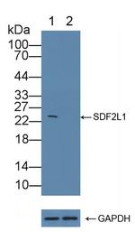 Collagen III Antibody in Western Blot (WB)