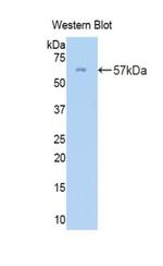 Collagen III Antibody in Western Blot (WB)