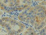 C2 Antibody in Immunohistochemistry (Paraffin) (IHC (P))