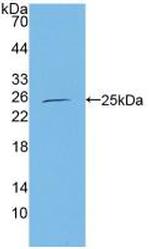 CBF beta Antibody in Western Blot (WB)