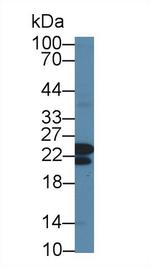 CBF beta Antibody in Western Blot (WB)