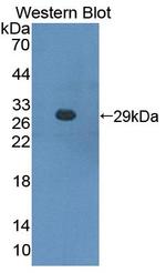 CBF beta Antibody in Western Blot (WB)