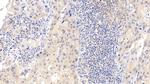 CDK4 Antibody in Immunohistochemistry (Paraffin) (IHC (P))