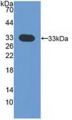 CDK4 Antibody in Western Blot (WB)