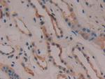 COX2 Antibody in Immunohistochemistry (Paraffin) (IHC (P))