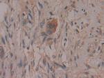 COX2 Antibody in Immunohistochemistry (Paraffin) (IHC (P))