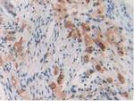 CYP26A1 Antibody in Immunohistochemistry (Paraffin) (IHC (P))