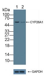 CYP26A1 Antibody in Western Blot (WB)