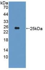 CYP26A1 Antibody in Western Blot (WB)