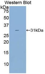 CYP21A2 Antibody in Western Blot (WB)