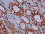 Cytokeratin 8 Antibody in Immunohistochemistry (Paraffin) (IHC (P))