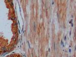 Cytokeratin 8 Antibody in Immunohistochemistry (Paraffin) (IHC (P))