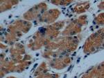 Cytokeratin 8 Antibody in Immunohistochemistry (Paraffin) (IHC (P))