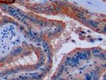 Cytokeratin 8 Antibody in Immunohistochemistry (Paraffin) (IHC (P))