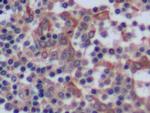 Cytokeratin 8 Antibody in Immunohistochemistry (Paraffin) (IHC (P))