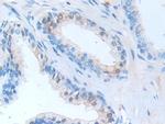 SERPINB9 Antibody in Immunohistochemistry (Paraffin) (IHC (P))