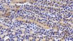 TRAIL-R2 (DR5) Antibody in Immunohistochemistry (Paraffin) (IHC (P))