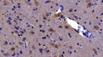 TRAIL-R2 (DR5) Antibody in Immunohistochemistry (Paraffin) (IHC (P))