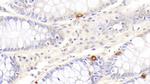 TRAIL-R2 (DR5) Antibody in Immunohistochemistry (Paraffin) (IHC (P))