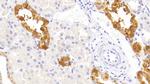 TRAIL-R2 (DR5) Antibody in Immunohistochemistry (Paraffin) (IHC (P))