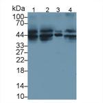 TRAIL-R2 (DR5) Antibody in Western Blot (WB)