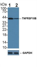 TRAIL-R2 (DR5) Antibody in Western Blot (WB)