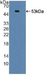 TRAIL-R2 (DR5) Antibody in Western Blot (WB)