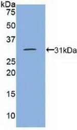 CD148 Antibody in Western Blot (WB)