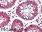 CD148 Antibody in Immunohistochemistry (Paraffin) (IHC (P))