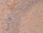 Dynamin 1 Antibody in Immunohistochemistry (Paraffin) (IHC (P))