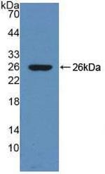 Dynamin 1 Antibody in Western Blot (WB)